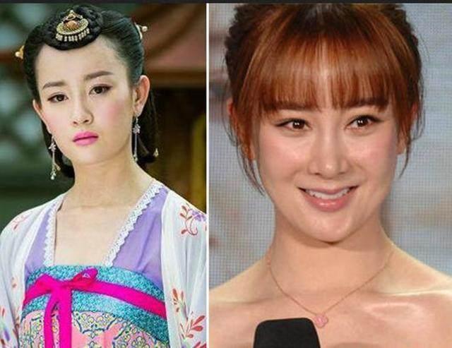 坦然面對整容，女明星的美麗新篇章之旅