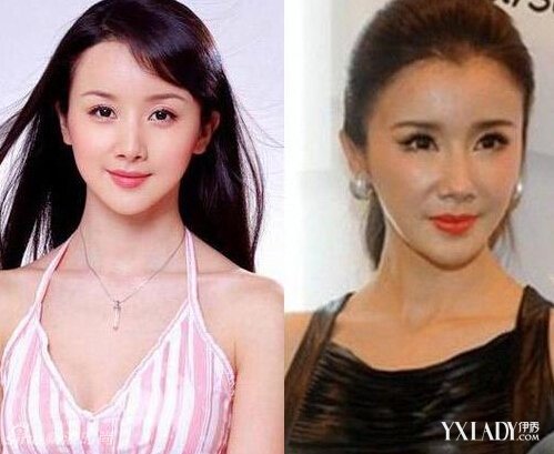 探秘明星整容的秘密，神秘美容小店的魅力所在！