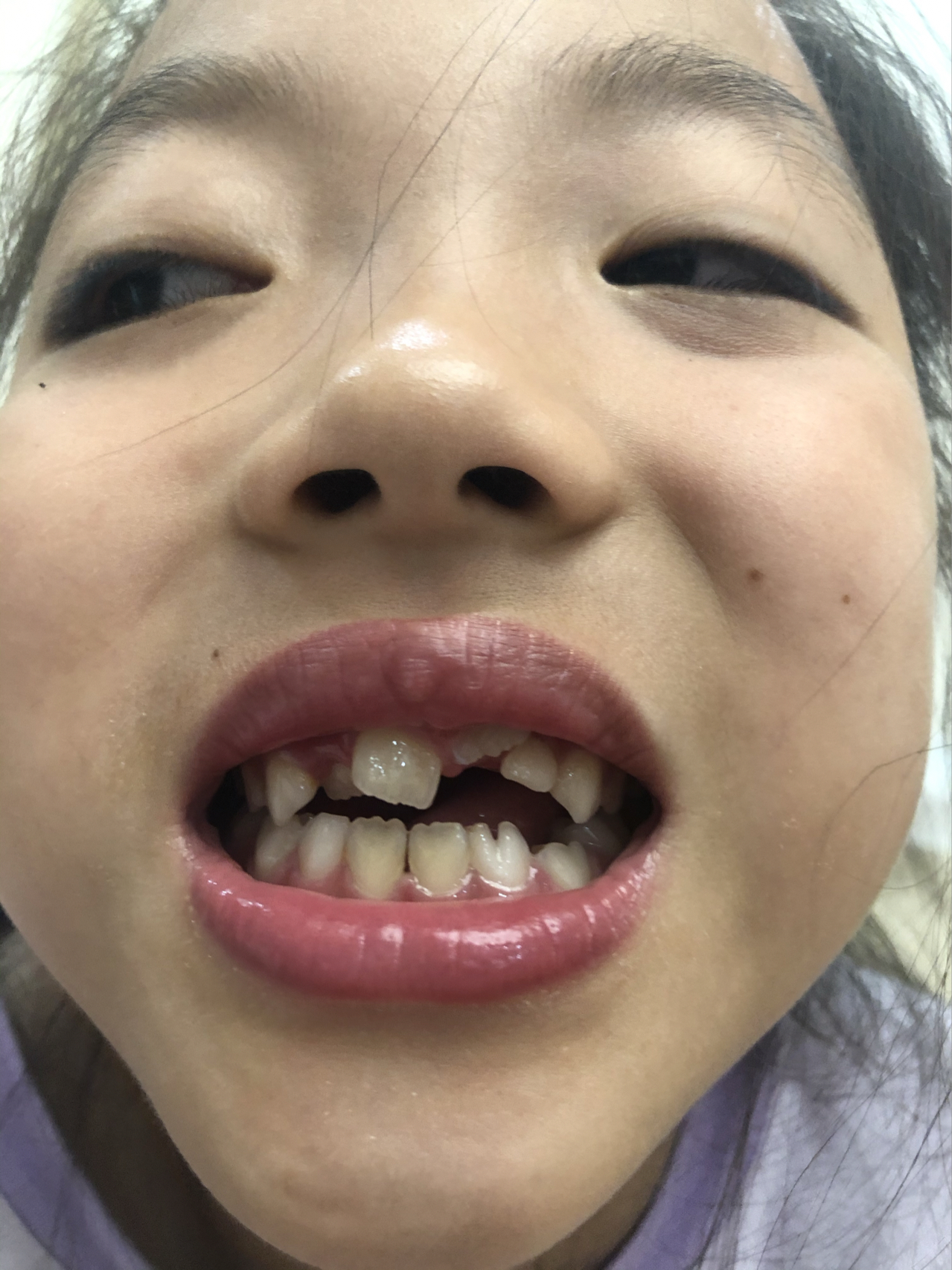 莊最新牙齒技術揭秘，牙齒美容新選擇
